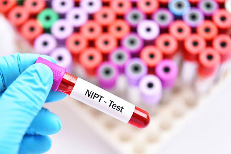 NIPT l&agrave; một v&iacute; dụ điển h&igrave;nh về ứng dụng ADN trong y học hiện đại&nbsp;