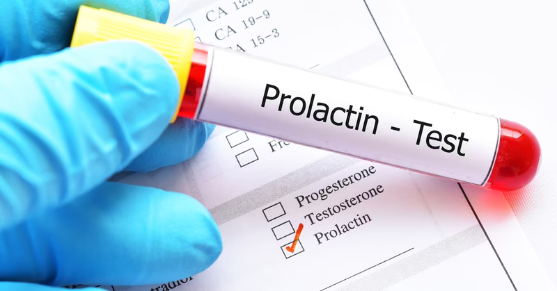 X&eacute;t nghiệm Prolactin gi&uacute;p đ&aacute;nh gi&aacute; chức năng tuyến y&ecirc;n để t&igrave;m nguy&ecirc;n nh&acirc;n g&acirc;y rối loạn kinh nguyệt, v&ocirc; sinh, hoặc tiết sữa bất thường