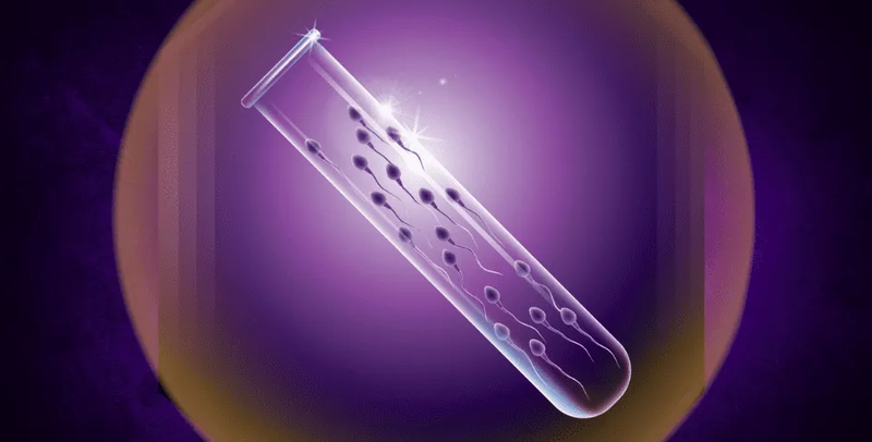 X&eacute;t nghiệm tinh dịch đồ l&agrave; x&eacute;t nghiệm quan trọng nhất đối với nam giới trước khi l&agrave;m IVF