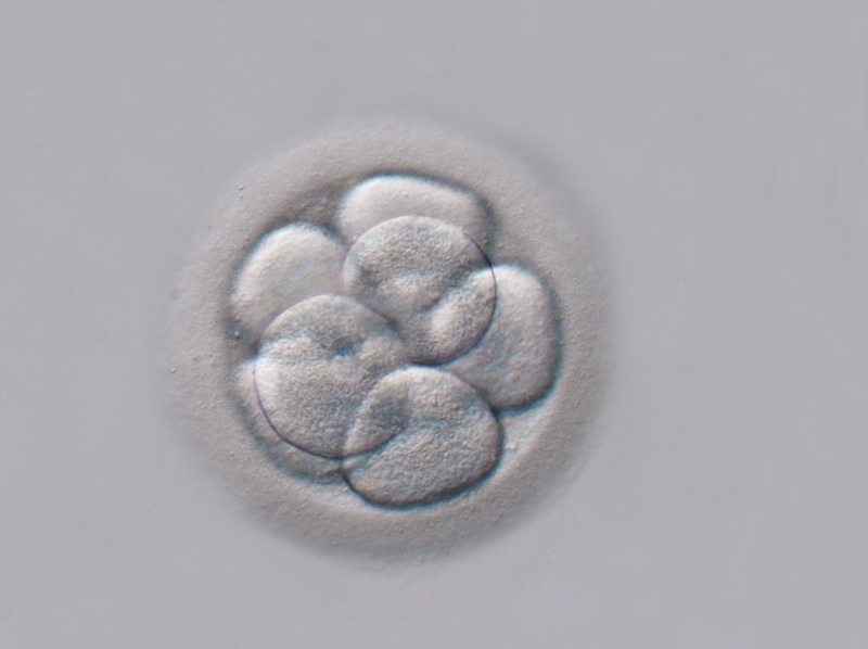 C&aacute;ch t&iacute;nh tuổi thai IVF chuyển ph&ocirc;i ng&agrave;y 3