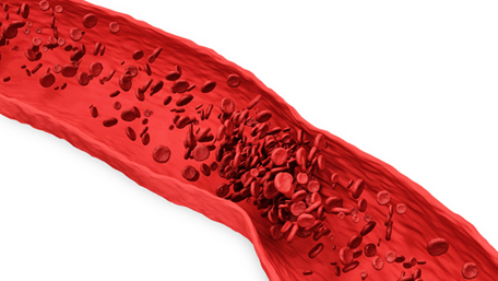 chi phí xét nghiệm gen đông máu