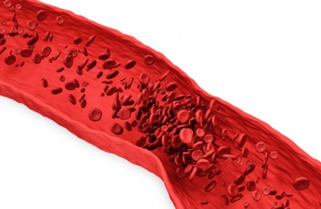 Mối liên hệ giữa nguy cơ sảy thai liên tiếp và đa hình gene gây Thrombophilia ở quần thể người Iran: Tổng quan hệ thống và phân tích tổng hợp – Iran Biomed J. 2018