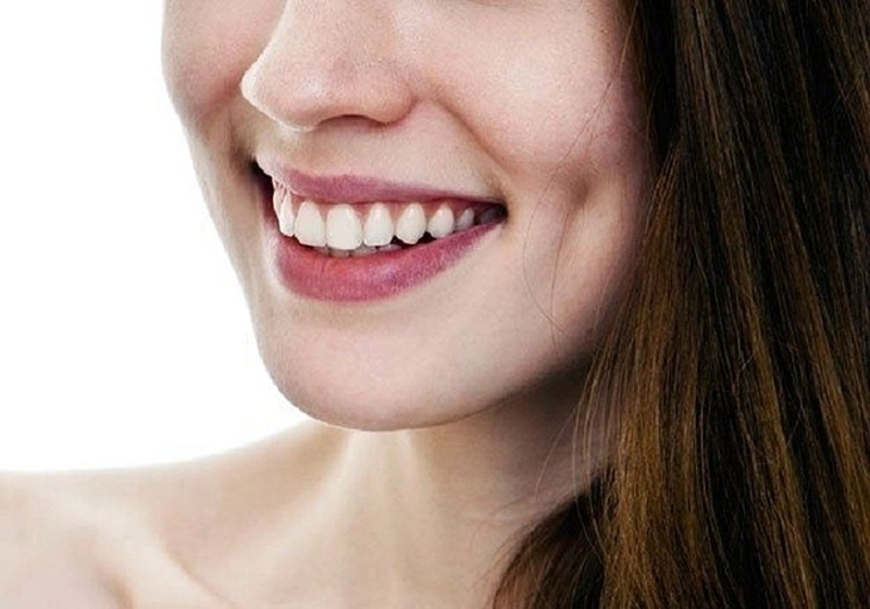 M&aacute; l&uacute;m l&agrave; một đặc điểm di truyền do gen trội
