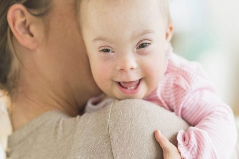 Trẻ sơ sinh mắc hội chứng si&ecirc;u nam Jacobs