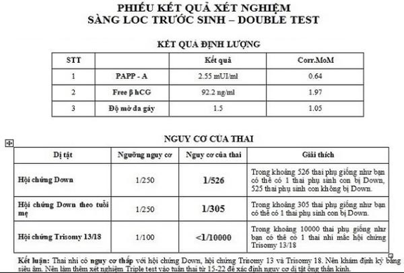 Mẫu phiếu kết quả x&eacute;t nghiệm Double test&nbsp;