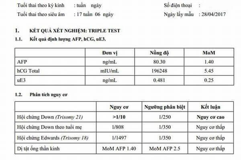 Kết quả s&agrave;ng lọc trước sinh Triple test cho biết thai nhi c&oacute; nguy cơ cao hội chứng Down, c&aacute;c chỉ số c&ograve;n lại b&igrave;nh thường&nbsp;