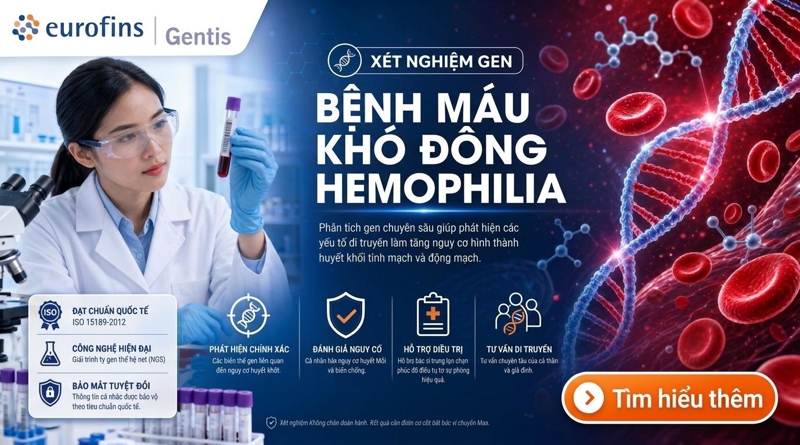 Bệnh M&aacute;u kh&oacute; đ&ocirc;ng (Hemophilia)