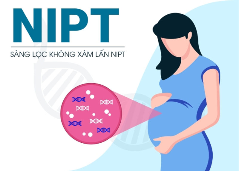 X&eacute;t nghiệm NIPT 3 nst an to&agrave;n, kh&ocirc;ng x&acirc;m lấn