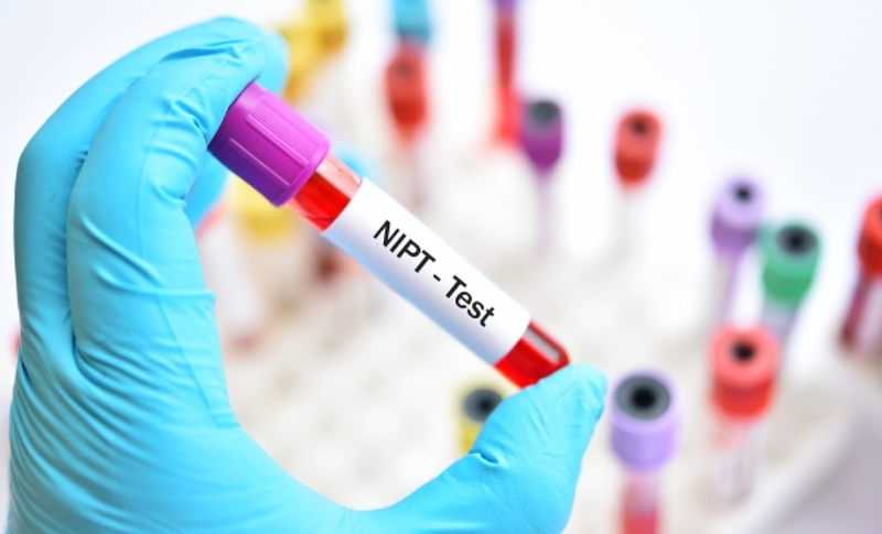 Mẹ n&ecirc;n thực hiện x&eacute;t nghiệm NIPT 3 cặp nhiễm sắc thể khi kết quả của Double Test hoặc Triple Test l&agrave; c&oacute; nguy cơ thai nhi bị dị tật&nbsp;