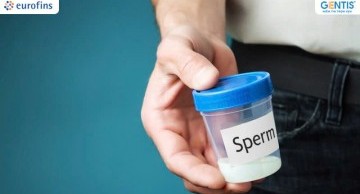 Xét nghiệm Sperm DNA - Giải pháp hiệu quả giúp bác sĩ chẩn đoán vô sinh nam