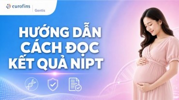 Hướng dẫn cách đọc kết quả NIPT chính xác