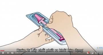 Tìm hiểu xét nghiệm HPV là gì?