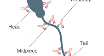 Xét nghiệm nam khoa - hỗ trợ bác sĩ chẩn đoán, điều trị hiếm muộn