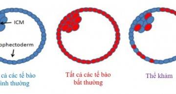 Tổng quan về phôi khảm và kết quả chuyển phôi thế khảm trong hỗ trợ sinh sản