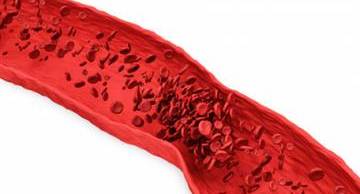 Mối liên hệ giữa nguy cơ sảy thai liên tiếp và đa hình gene gây Thrombophilia ở quần thể người Iran: Tổng quan hệ thống và phân tích tổng hợp – Iran Biomed J. 2018