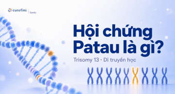 Hội chứng Patau là gì