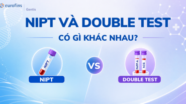 So sánh NIPT và Double Test chi tiết