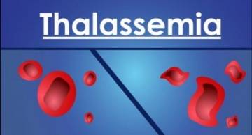 Cần chuẩn bị chi phí xét nghiệm Thalassemia là bao nhiêu?