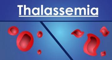 Nên thực hiện xét nghiệm gì để biết bệnh Thalassemia?