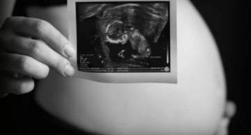 Tìm thấy ADN con trai trong não người mẹ