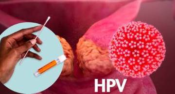 HPV tự thu - Giải pháp tối ưu trong mùa dịch