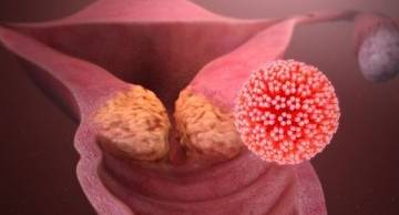 HPV có mấy loại? Các hình thức lây lan của virus HPV?