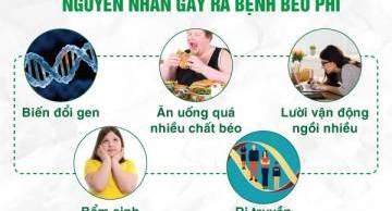 Top 7 nguyên nhân gây béo phì phổ biến hiện nay