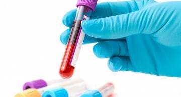 Xét nghiệm ADN hành chính