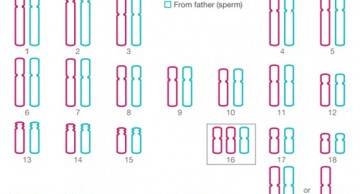 Các mẹ bầu đã biết về lệch bội nhiễm sắc thể hiếm gây nguy hiểm cho thai nhi?