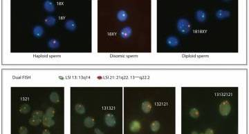 FISH - Xét nghiệm chẩn đoán lệch bội nhiễm sắc thể tinh trùng