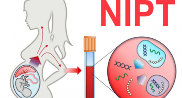 Xét nghiệm NIPT và chọc ối, mẹ bầu nên chọn phương pháp nào?