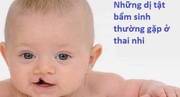 8 dị tật bẩm sinh thường gặp ở thai nhi mẹ bầu nên chú ý
