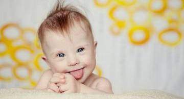 5 thông tin quan trọng về dị tật thai nhi hội chứng Down cần nắm rõ