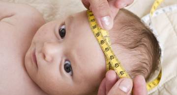 5 thông tin quan trọng về dị tật thai nhi đầu nhỏ mẹ bầu cần biết