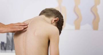 5 Dị tật bẩm sinh về cột sống thường gặp và cách phòng ngừa