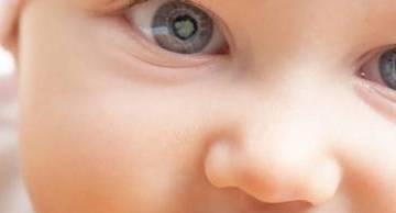 4 Dị tật mắt ở thai nhi thường gặp và cách phát hiện chính xác