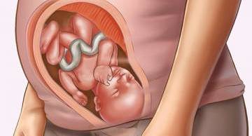 9 bí quyết ngăn ngừa dị tật thai nhi mẹ bầu cần biết