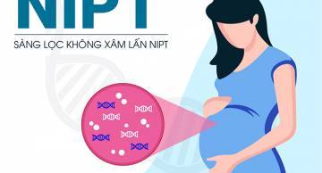 Những ai cần làm xét nghiệm NIPT? 7 đối tượng nguy cơ cao
