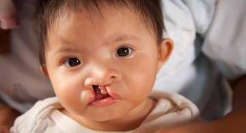 Điểm mặt 7 yếu tố tăng nguy cơ dị tật thai nhi, mẹ bầu cần lưu ý