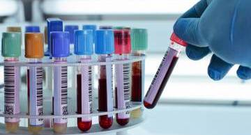 Chi tiết quy trình 5 bước sàng lọc trước sinh và lưu ý cho mẹ