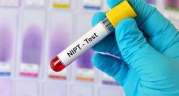 NIPT là xét nghiệm gì? 6 điều cần biết về xét nghiệm NIPT