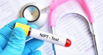 [Giải đáp thắc mắc]: Làm xét nghiệm NIPT rồi có cần làm Triple test không?