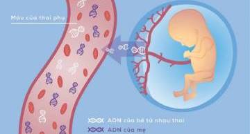 5+ thông tin quan trọng về xét nghiệm NIPT 3 cặp nhiễm sắc thể