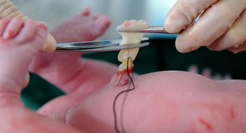 Xét nghiệm ADN cần lấy mẫu gì