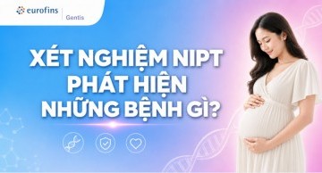 Xét nghiệm NIPT phát hiện những bệnh gì