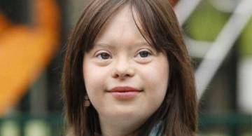 Hội chứng Down là gì và những kiến thức liên quan mẹ bầu cần biết