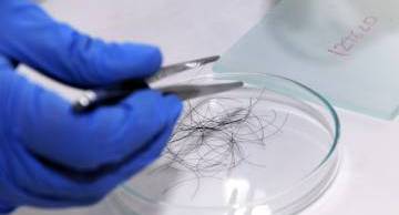 Tôi có thể xét nghiệm ADN bằng tóc không?