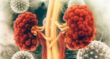 Phát hiện đột biến di truyền liên quan đến bệnh thận đa nang sử dụng công nghệ giải trình tự thế hệ mới (NGS)