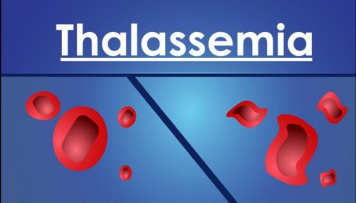 Phương pháp sàng lọc phôi thalassemia hiện nay?
