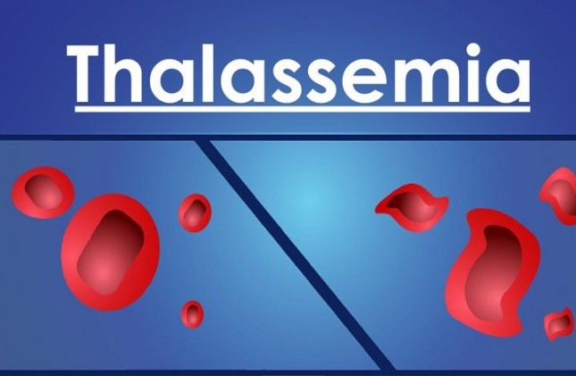 Nên thực hiện xét nghiệm gì để biết bệnh Thalassemia?